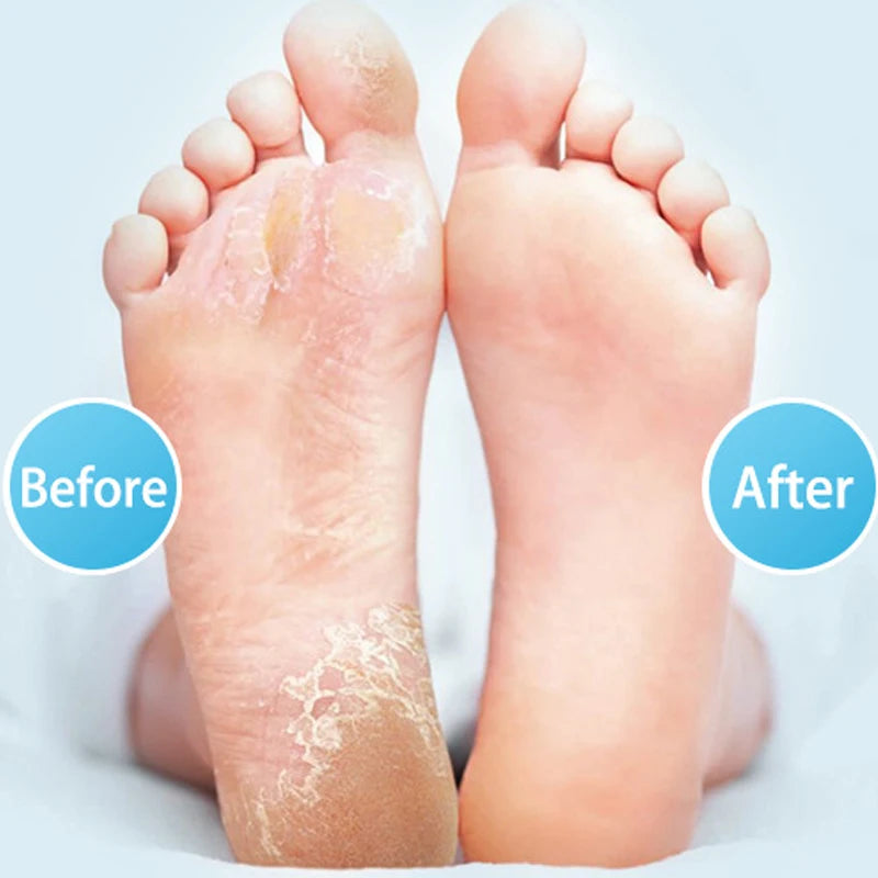 Ponceuse pour Pied Professionnelle